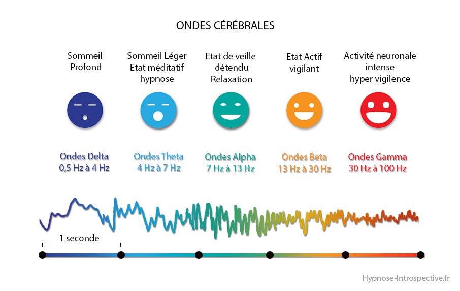 ondescerebralessitefr ondescerebralessitefr